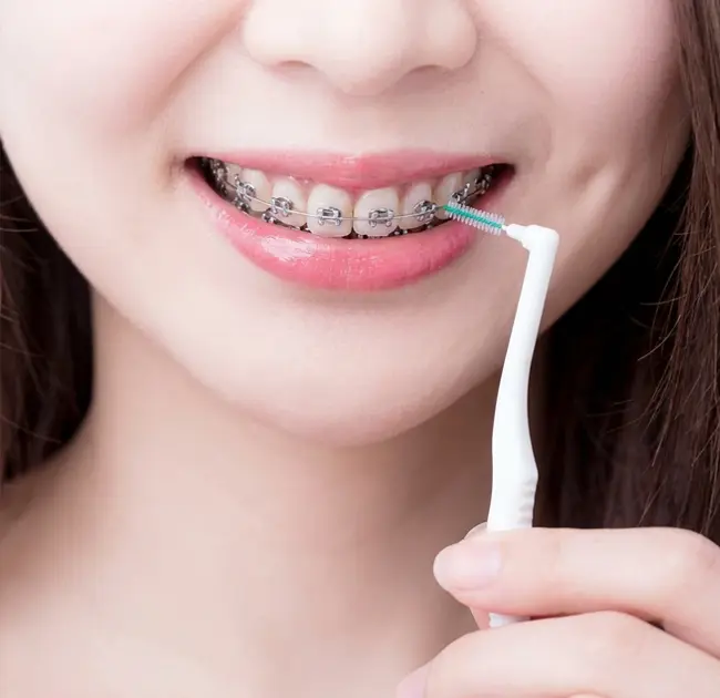 Interdental Brushes Create a New Experience of Refined Oral Care